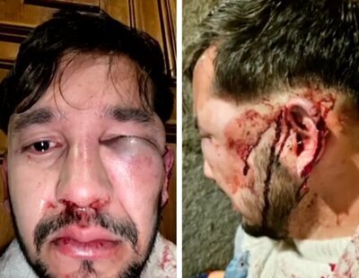 Brutal agresión homófoba en pleno centro de Madrid: "Maricón de mierda, te voy a matar"