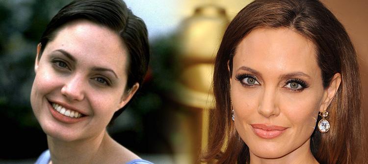 Angelina Joline, antes y después