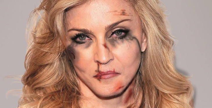 Madonna, golpeada (Facebook: Alexsandro Palombo)