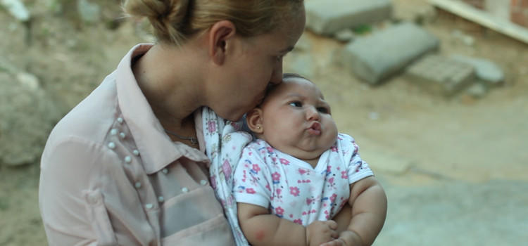 Se ha relacionado el virus del Zika con la microcefalia en bebés