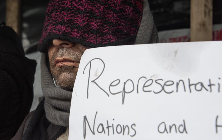 Un refugiado se cose los labios en protesta por el desmantelamiento de Calais