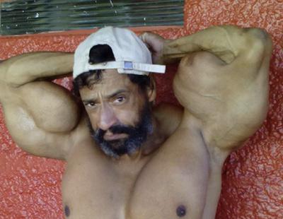 Un culturista brasileño se inyecta aceite en los bíceps para aumentar el diámetro de sus brazos