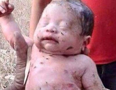 Aidin, el bebé que sobrevivió a 14 puñaladas, posa sonriente