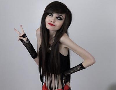 Piden el cierre de la cuenta de esta Youtuber por incitar a la anorexia