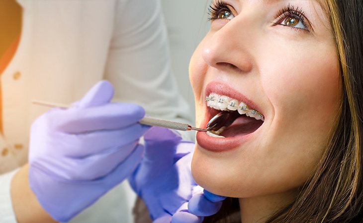 Llevar ortodoncia es muy común actualmente