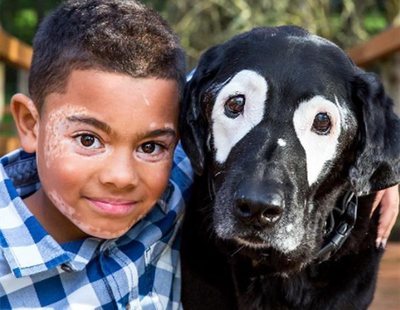 Un niño sale de la depresión tras conocer a un perro con vitiligo, su misma enfermedad