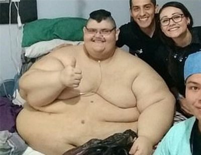 El sorprendente cambio del 'hombre más obeso del mundo' tras perder 200 kilos
