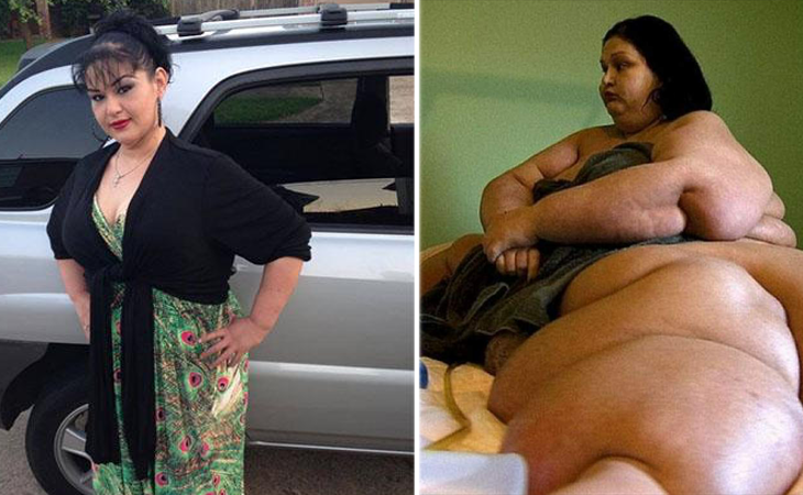 El increíble cambio físico la mujer más obesa del mundo - Los Replicantes