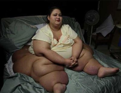 El increíble cambio físico de la mujer más obesa del mundo