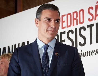 Todas las cirugías estéticas que se ha hecho Pedro Sánchez