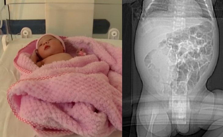 Da a luz a una niña que estaba