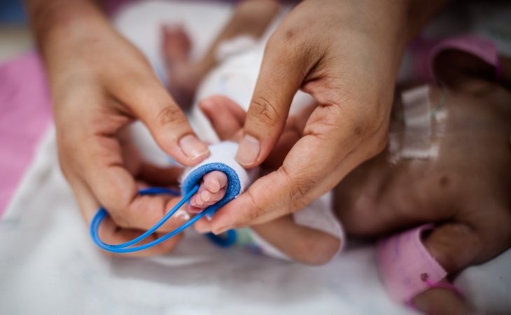Un bebé extremadamente prematuro nace en torno a las 24 semanas de gestación