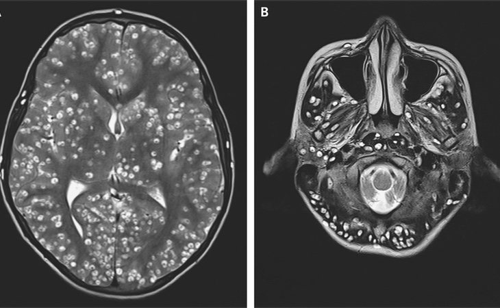 Escaneo del cerebro del joven fallecido