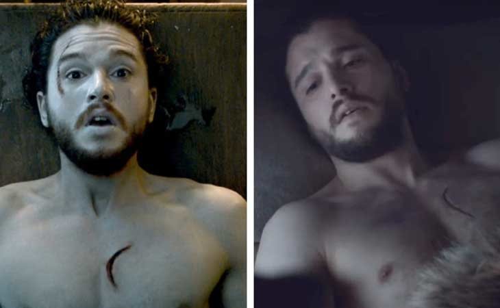 La cicatriz de Jon Snow