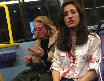 Brutal agresión homófoba a una azafata y su novia en un autobús nocturno de Londres