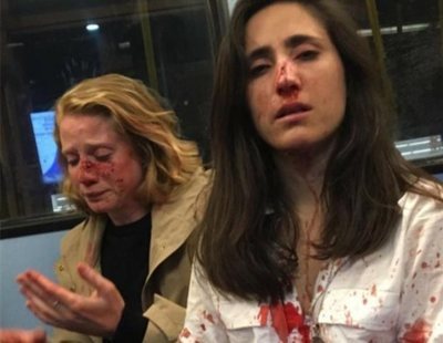 Cinco adolescentes detenidos por la brutal agresión homófoba a dos lesbianas en Londres