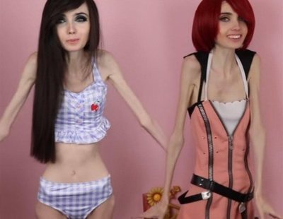 La saludable reaparición de Eugenia Cooney, youtuber que sufre anorexia