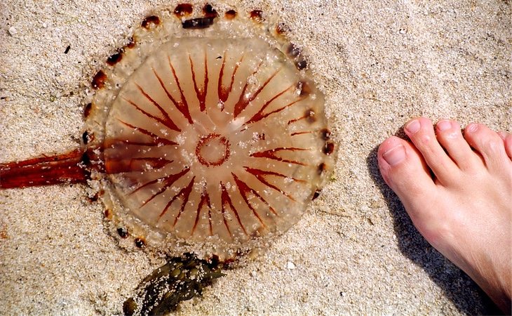 Las picaduras de medusa deben ser siempre tratadas con agua salada tras su localización