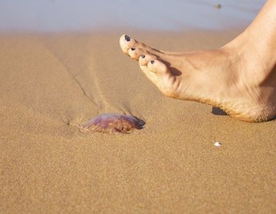 Vinagre contra las picaduras de medusa: ¿Verdad o mito?