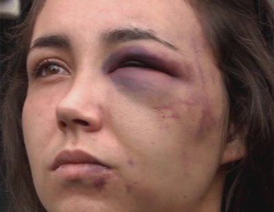 Violencia de género: Rebeca escapa por la ventana de la brutal paliza de su novio