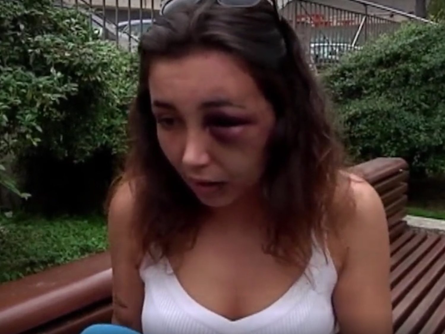 Violencia de género: Rebeca escapa por la ventana de la brutal paliza de su novio