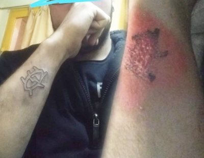 Se hace un tatuaje, se arrepiente a la semana y decide quitárselo con un rallador de queso