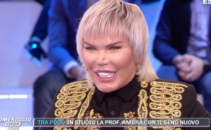 Rodrigo Alves ha pasado por el quirófano más de 100 veces para someterse a tratamientos estéticos