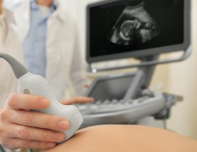 Eslovaquia obligará a las mujeres que quieran abortar a ver al feto antes de hacerlo