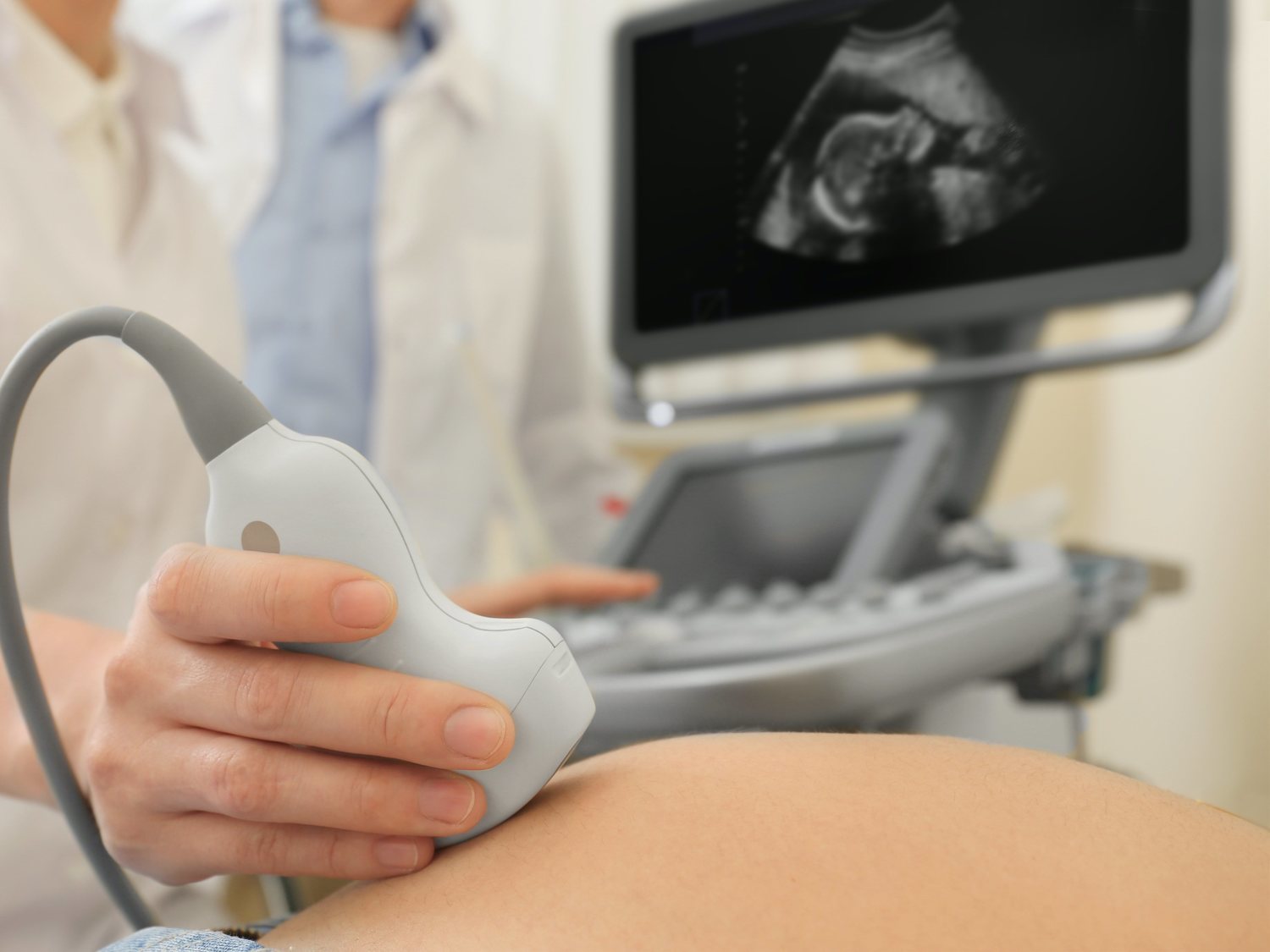 Eslovaquia obligará a las mujeres que quieran abortar a ver al feto antes de hacerlo