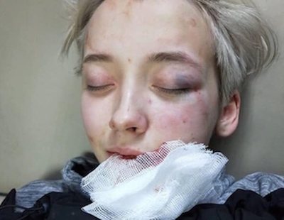 Siete hombres golpean a una joven de 18 años por su orientación sexual en San Petersburgo