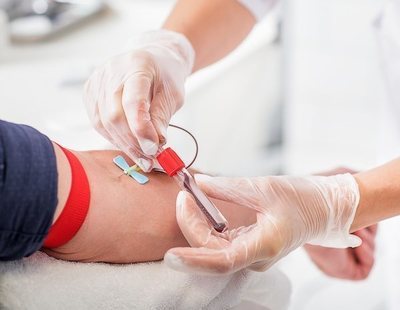 Las extracciones de sangre sin agujas ni dolor ya son una realidad