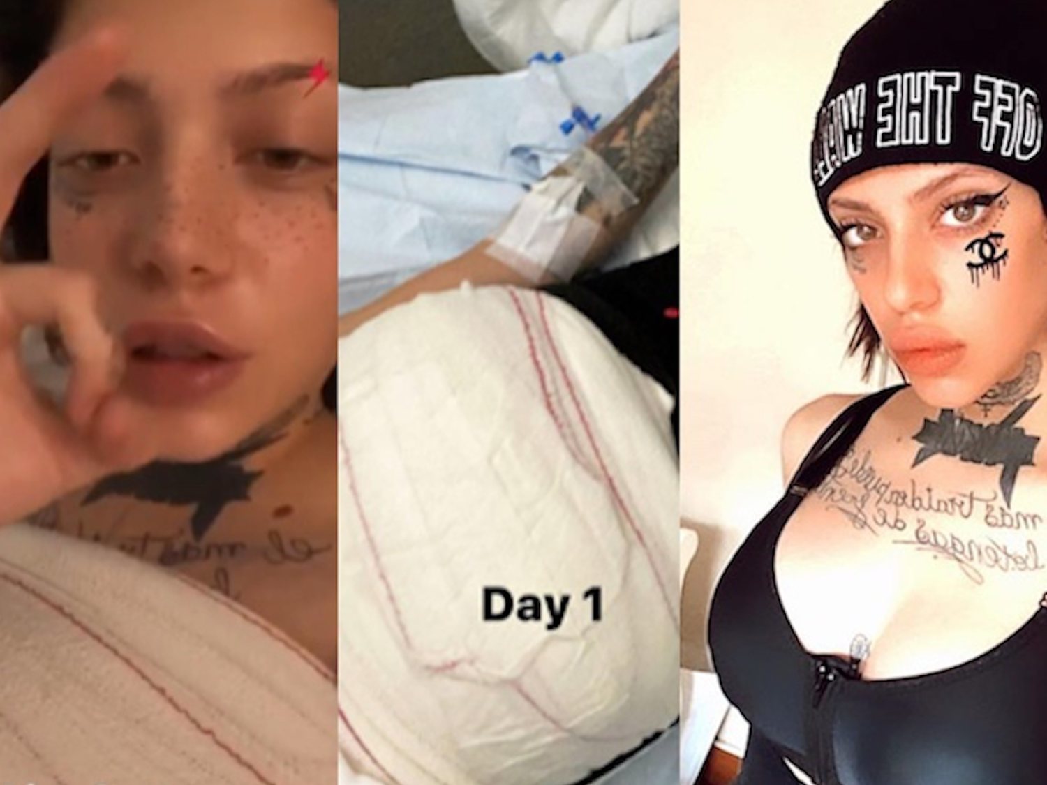 El brutal cambio físico de Valeria Quer a base de cirugías estéticas con solo 19 años