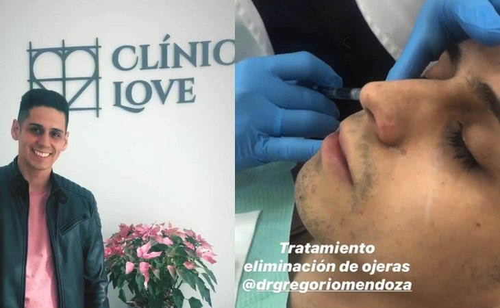 Christofer se ha sometido a la eliminación de ojeras