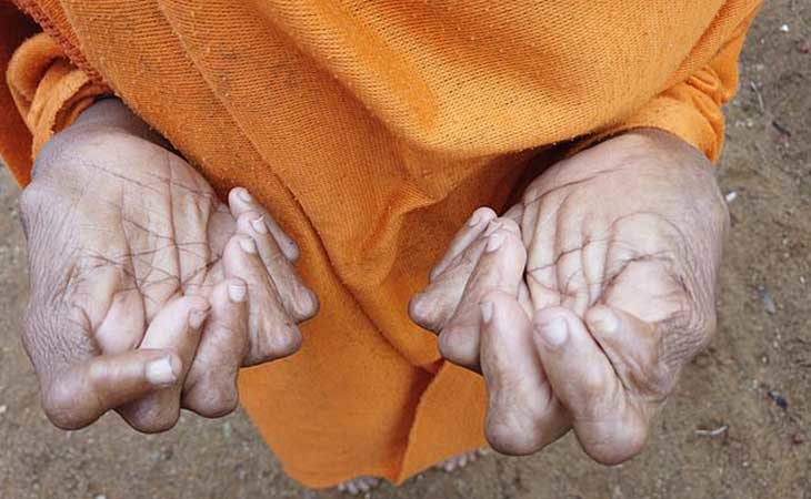 Los 12 dedos de las manos de Kumari Nayak