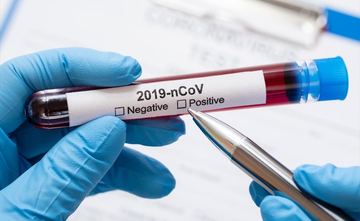 La incertidumbre que genera la pandemia del coronavirus está dañando la economía