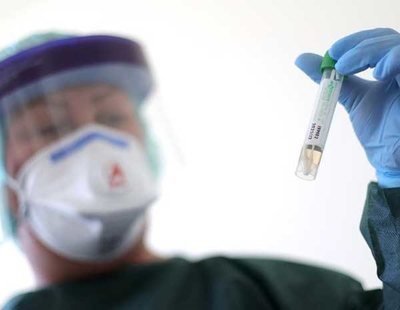 El test del coronavirus más vendido en España no es válido
