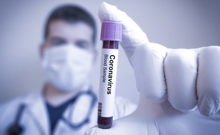 Los test de coronavirus que se están realizando en España no tienen una sensibilidad efectiva