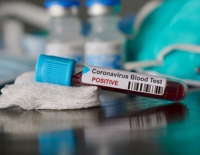 China acusa a España de comprar test de coronavirus sin licencia y el Gobierno indica su homologación europea
