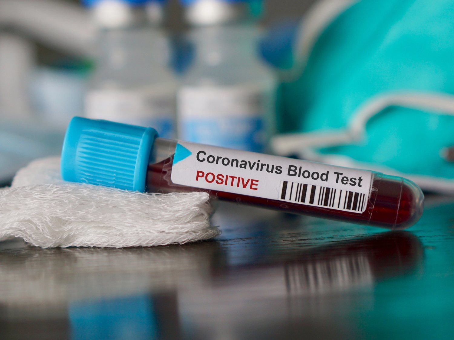 China acusa a España de comprar test de coronavirus sin licencia y el Gobierno indica su homologación europea