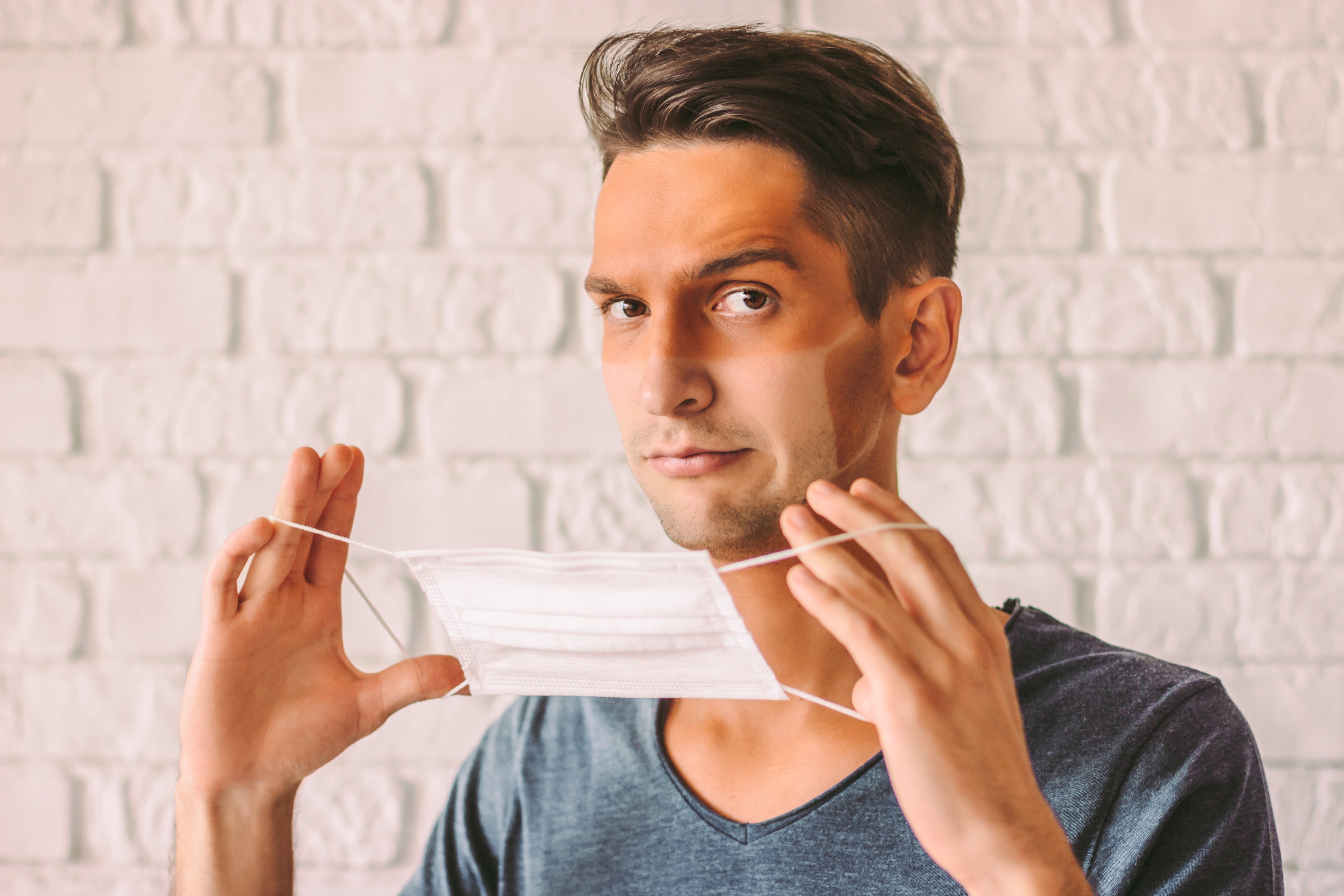 Retrato de hombre confundido con graciosas líneas de sol en la cara sosteniendo máscara protectora en la mano. Joven hipster con piel bronceada quemada después de usar mascarilla médica