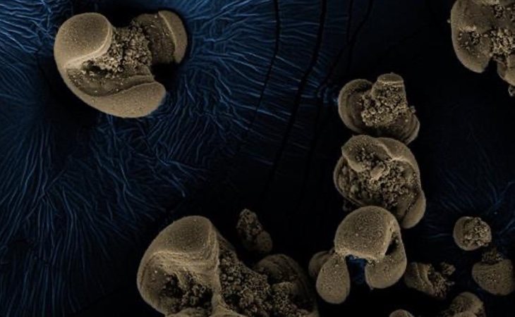 La bacteria ha sido descubierta de manera completamente accidental
