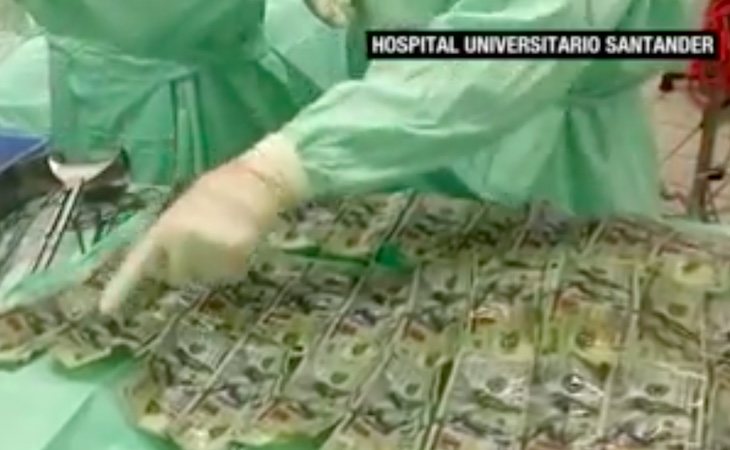 Imagen de dinero extraído del intestino de la mujer