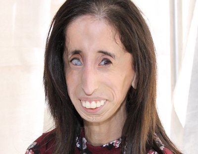 La activista Lizzie Velasquez pide que dejen de usar su rostro en un cruel reto viral