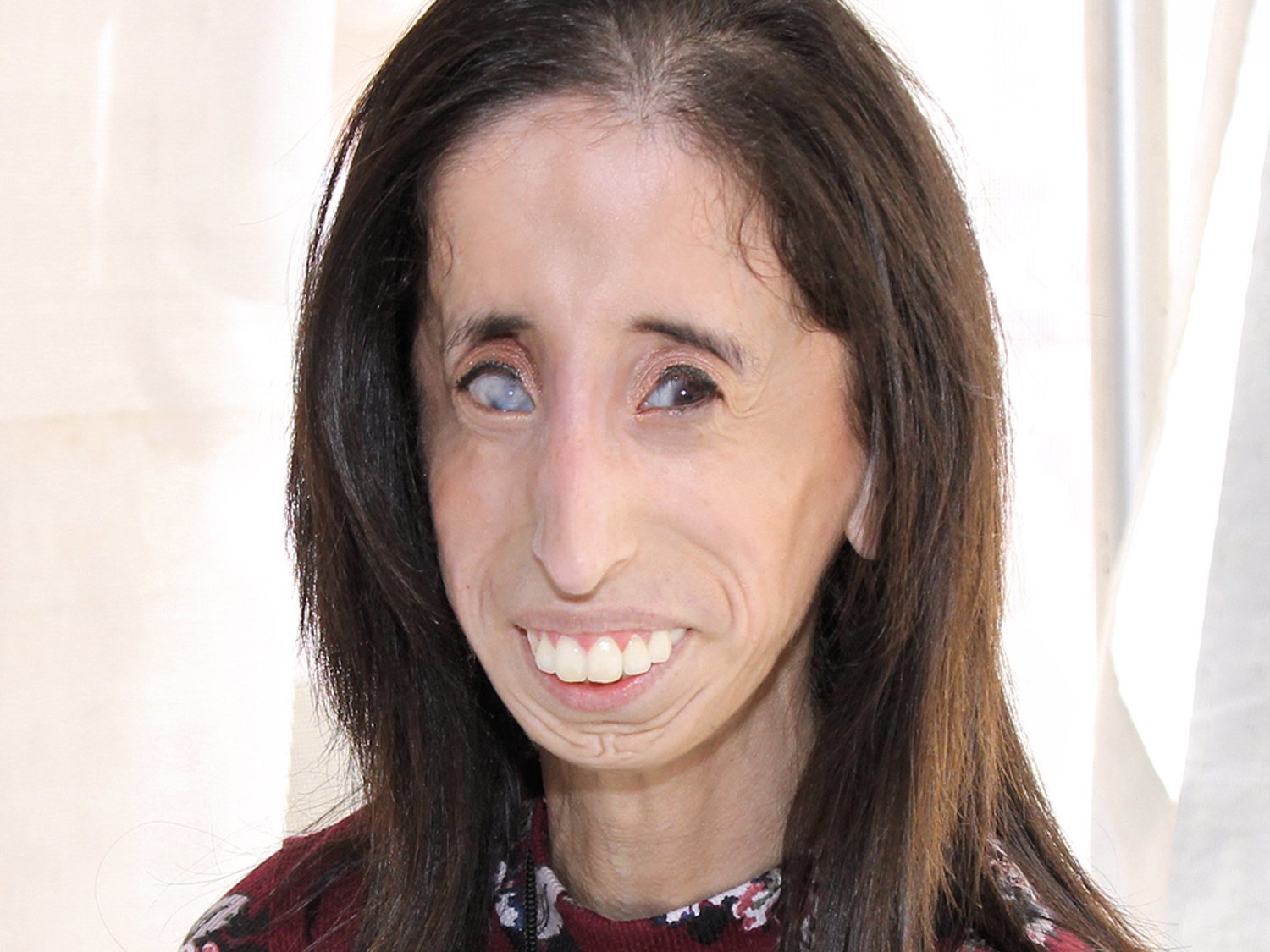 La activista Lizzie Velasquez pide que dejen de usar su rostro en un cruel reto viral