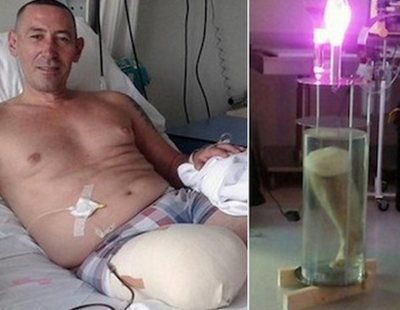 Convierte su pierna amputada en una lámpara y la intenta vender en eBay por 108.000 euros