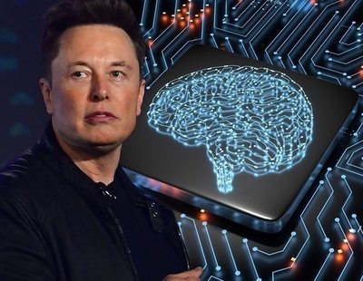 Elon Musk inserta un implante cerebral en un cerdo: "Será como un Fitbit pero dentro de tu cráneo"