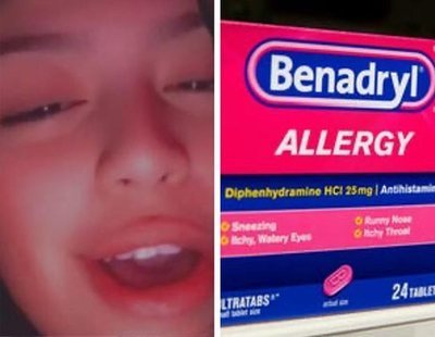 Así es el peligroso Benadryl Challenge que ha causa la muerte de una adolescente por sobredosis