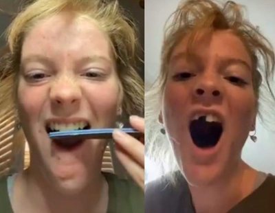 El dañino reto viral que sacude internet: gente limándose los dientes ante la cámara