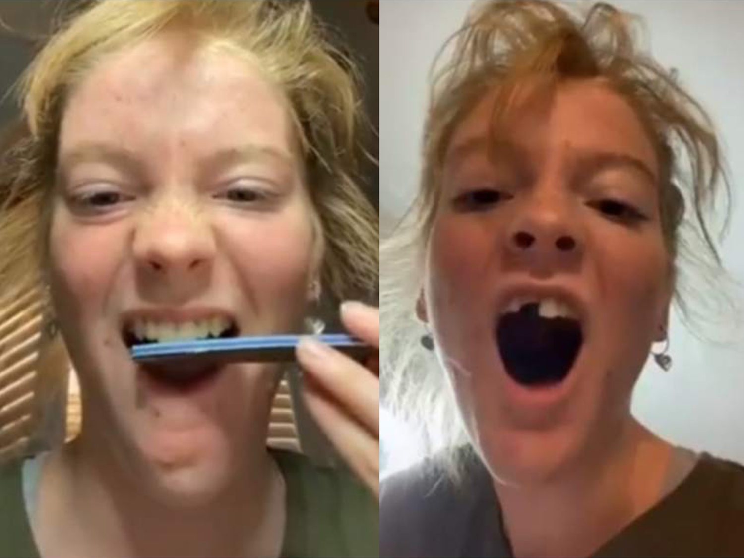 El dañino reto viral que sacude internet: gente limándose los dientes ante la cámara