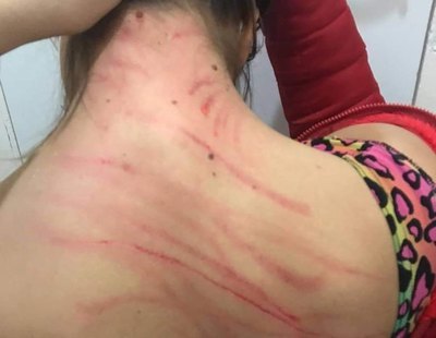 Abusan sexualmente y agreden a una joven trans en Madrid: "¡Os vamos a matar!"